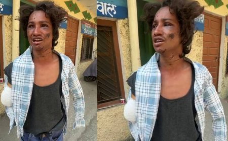 घनसाली में: मानवता हुई शर्मसार मां, भाई और भाभी ने मिलकर किया युवक पर जानलेवा हमला