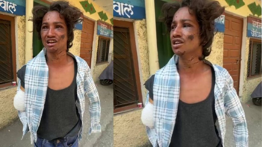 घनसाली में: मानवता हुई शर्मसार मां, भाई और भाभी ने मिलकर किया युवक पर जानलेवा हमला