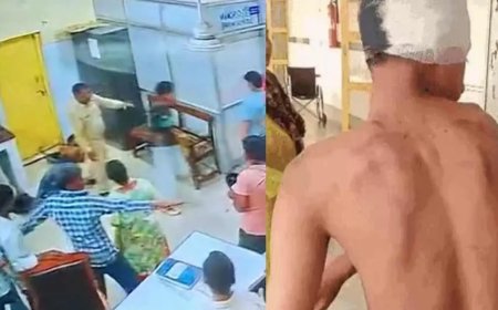 हल्द्वानी न्यूज़: बेस अस्पताल इमरजेंसी वार्ड में लात-घूसे चलने का मामला
