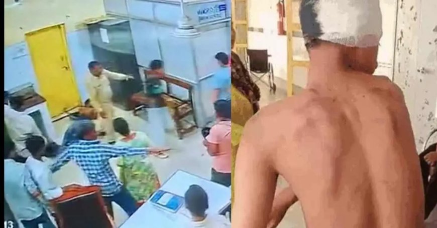 हल्द्वानी न्यूज़: बेस अस्पताल इमरजेंसी वार्ड में लात-घूसे चलने का मामला